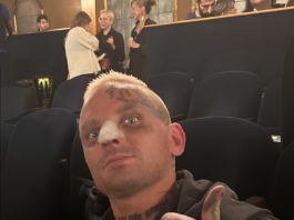 Darby Allin Sidelined After Being Hit by a Bus During Injury Break