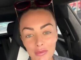 Mandy Rose Reverses Cosmetic Surgery and Explores New Horizons